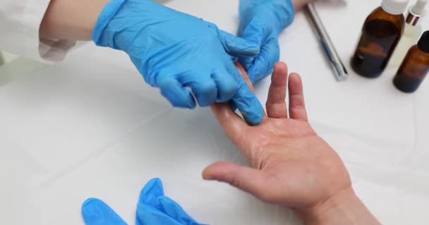 연구자는 손가락에 부서진 샘플을 복용하기 손가락에 특별한 크림을 적용합니다 간호사는 — 비디오