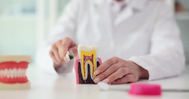 Οδοντίατρος Αγγίζοντας Τεχνητό Μοντέλο Δοντιού Ειδική Οδοντόβουρτσα Ιατρός Παρουσιάζει Σήψη — Αρχείο Βίντεο