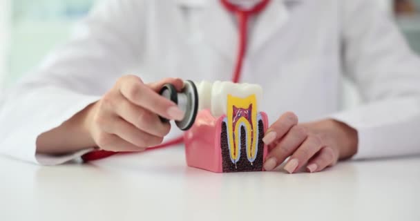 Tandläkare Vidrör Artificiell Modell Tand Med Stetoskop Läkaren Visar Förruttnad — Stockvideo