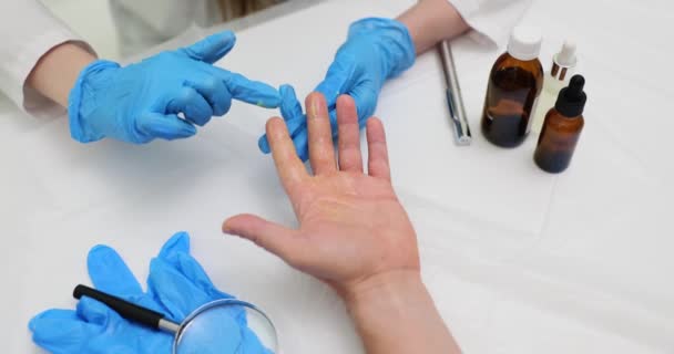Doctorul Mănâncă Mâinile Unguent Pentru Trata Pacienții Arsuri Tratament Pielii — Videoclip de stoc