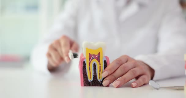 Dentista Muestra Modelo Dientes Cepilla Los Dientes Correctamente Con Cepillo — Vídeos de Stock