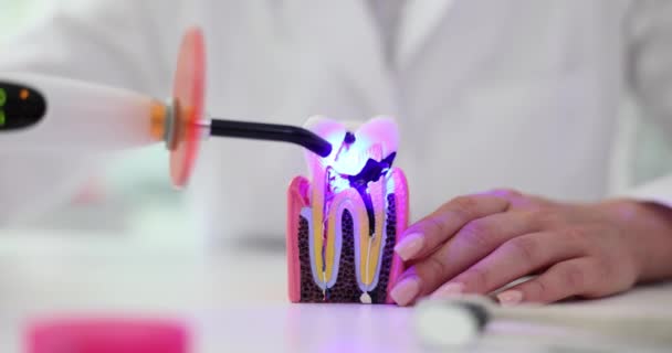 Lâmpada Fotopolímero Doutor Com Uma Lâmpada Azul Brilhante Dente Com — Vídeo de Stock