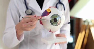 Doctor ophthalmologist showing disease on artificial model of human eye closeup 4k movie slow motion. Diagnosis and treatment of eye diseases concept
