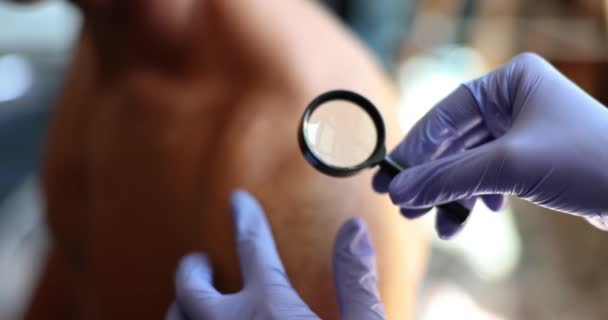 Doctor Dermatologist Examining Rash Skin Magnifying Glass Closeup Movie Slow — Stok Video