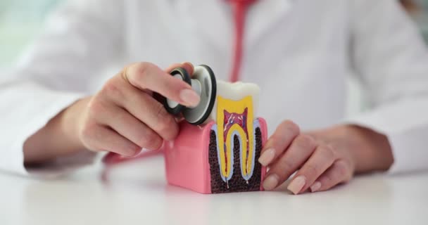 Dişçinin Ellerinde Beyaz Sağlıklı Diş Steteskop Diş Tanısı Tedavi — Stok video