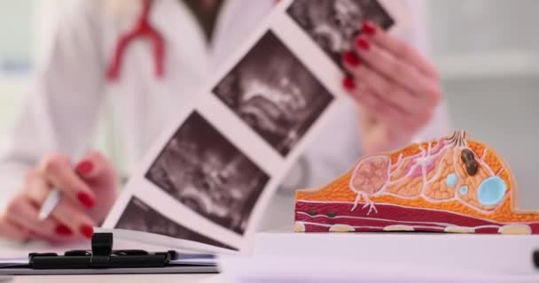 Mammolog Kadın Göğüslerinin Ultrason Sonuçlarının Fotoğraflarını Inceliyor Göğüs Hastalıkları — Stok video