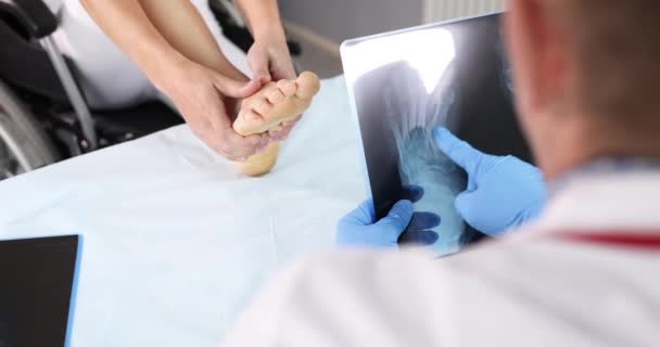 Der Arzt Untersucht Ein Röntgenbild Des Patienten Mit Fußschmerzen Fußschmerz — Stockvideo