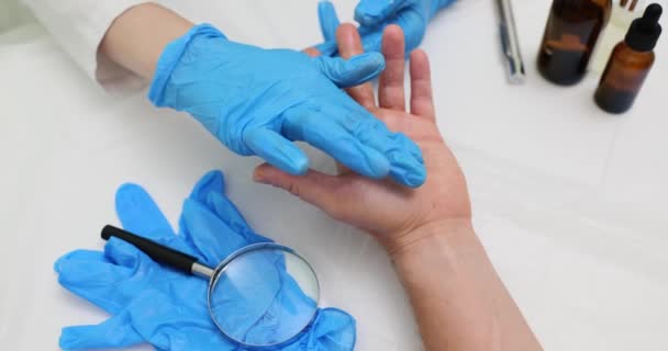 助理员在男性手指上涂特殊药膏 取手指上裂开的皮肤样本 研究人员揉搓人的手指检查慢动作 — 图库视频影像