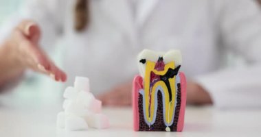Doktor yapay diş modelinde çürükler gösteriyor. Diş hekimi asistanı, diş bakımı eksikliği ve ağır çekim örnekleri gösteriyor