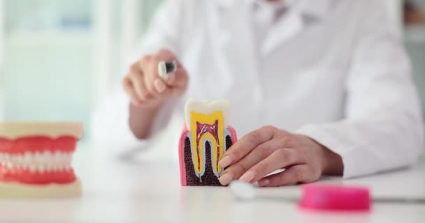 의사는 검사실에서 칫솔로 치아의 모델을 청소합니다 실습자는 클리닉 슬로우 모션에서 — 비디오