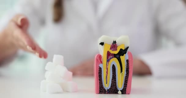Doutor Mostrando Cavidades Modelo Dente Artificial Assistente Dentista Mostrando Exemplos — Vídeo de Stock
