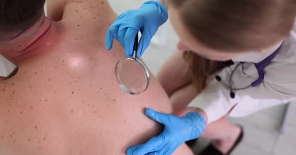 Dermatolog Tittar Födelsemärken Människan Tillbaka Genom Förstoringsglas Man Tillbaka Med — Stockvideo