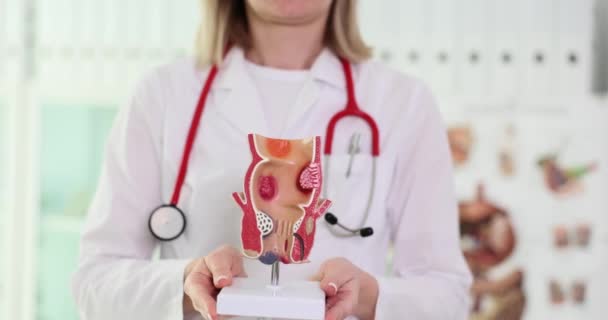 医师手握人工模型的人类直肠特写4K片 痔疮的诊断和治疗 — 图库视频影像