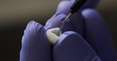 Ortopedik diş hekimi kapanış filmi için diş macununa yapıştırıcı sürüyor. Diş protezi yerleştirme konsepti