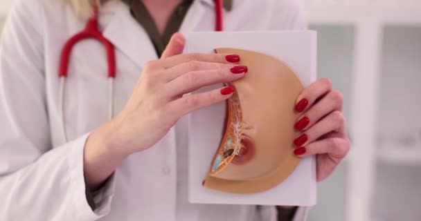 Arzt Zeigt Wie Man Unabhängig Untersuchen Brust Auf Künstliche Modell — Stockvideo