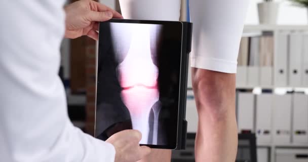Arzt Bei Der Computeruntersuchung Des Kniegelenks Mittels Digitalem Tablet Film — Stockvideo