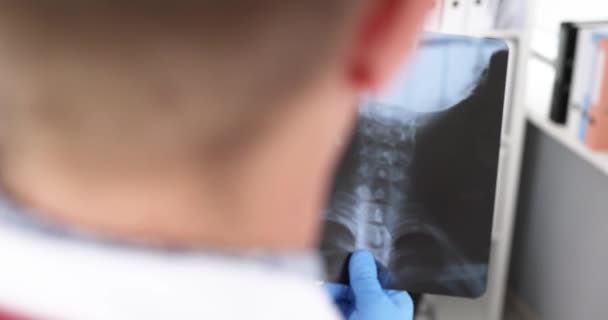 Arzt Neurologe Hält Röntgenbild Der Halswirbelsäule Und Drückt Auf Schmerzpunkte — Stockvideo