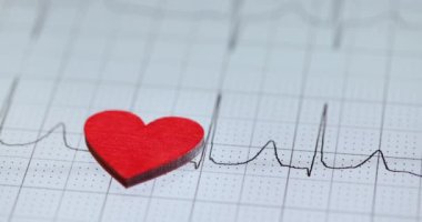 Kırmızı küçük kalp kardiyogramda yatar. ECG yorumu ve önemli göstergeler kavramı