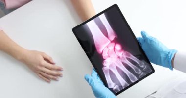 Doktor tableti hastanın elinin röntgeniyle tutuyor. Kemik ve eklem iltihabı kavramı