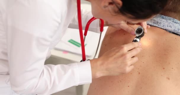 Dermatologe Onkologe Untersucht Muttermale Durch Vergrößerungsglas Auf Dem Rücken Des — Stockvideo