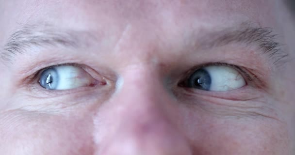 Человек Голубыми Глазами Делает Разминку Глаз Спортивная Гимнастика Восстановления Концепции — стоковое видео