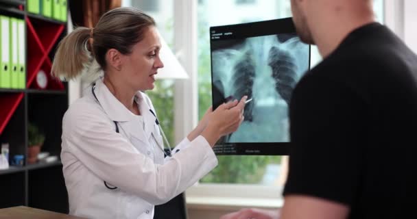 医者は人への肺のX線の損傷した区域を指す 医学と日常検査 — ストック動画