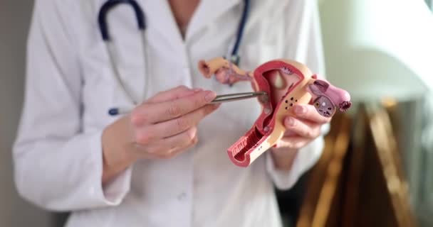 Medico Ginecologo Mostra Modello Anatomico Utero Ovaie Con Patologie Primo — Video Stock