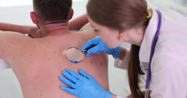 Dermatolog Undersöker Patienten Mullvad Med Hjälp Förstoringsglas Kliniken Förvärvad Melanocytisk — Stockvideo