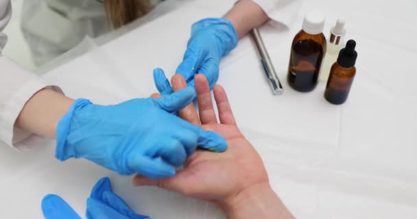 Tangan Dokter Memegang Tangan Manusia Dengan Luka Bakar Dan Salep — Stok Video