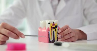 Dişçi, birden fazla dişi olan plastik bir diş modeline işaret ediyor. Doktor, tıbbi uzmanlarla ağız hastalıklarının yıkıcı etkileri hakkında konuşuyor.