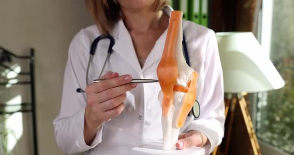 Cerrah Diz Eklemi Tendon Modelini Klinikte Gösteriyor Eklem Değişimi Artroskopi — Stok video