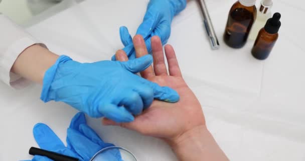 Dermatologist Applies Healing Ointment Treat Patient Hand Hand Skin Problem — Stock Video