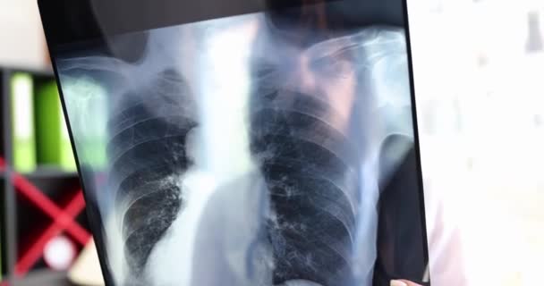 Een Dokter Met Een Röntgenfoto Zijn Handen Een Close Diagnostiek — Stockvideo