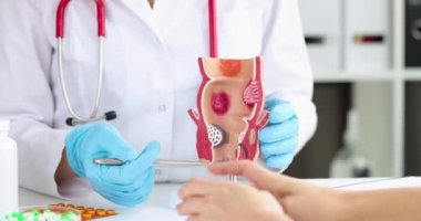 Doktor proktolog, rektum kapanış filminin yapay modelinde hasta hastalığı gösteriyor. Hemoroit tedavi kavramı