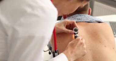 Doktor, klinik 4k filminde dermatoskoplu erkek hastanın pigmentli Beni 'sini inceliyor. Cilt kötü huylu neoplazma kavramının önlenmesi