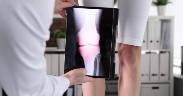 医生创伤性扫描妇女膝盖酸痛使用数码平板在临床4K电影慢动作 类风湿关节炎的诊断与治疗 — 图库视频影像
