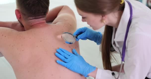 Dermatolog Undersöker Patienten Tillbaka Med Förstoringsglas Kliniken Förvärvad Melanocytisk Nevus — Stockvideo