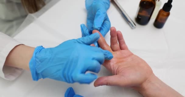 Врач Применяет Лечебную Мазь Лечения Руки Пациента Лечение Пятнистой Кожи — стоковое видео