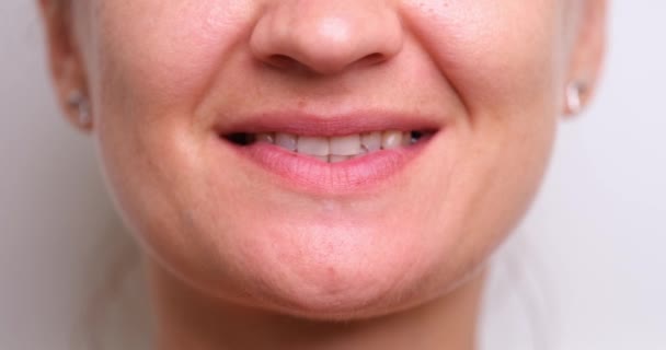 牙齿残缺 受伤和损坏的修复 门牙碎了的笑脸女人的衣服 — 图库视频影像