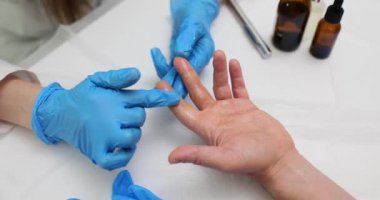 Muayene asistanı, klinikte kırık deri örneği almak için parmağa özel krem uygular. Doktor yavaş çekimde kazıma analizi için alkol sarıyor.