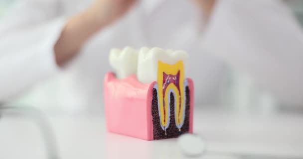 ドクターは 保護を作る歯人工モデルの両側に手を置きます 矯正歯科医の重要な職業と人間の歯の遅い動きの構造を研究する — ストック動画
