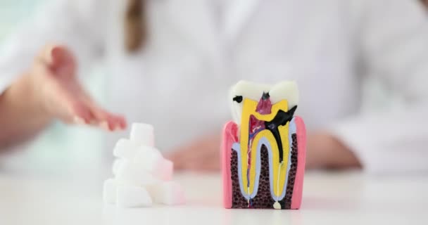 Mulher Médica Demonstra Montão Cubos Açúcar Perto Modelo Plástico Dente — Vídeo de Stock