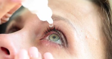 Close-up face woman is dripping medicine in the eye, slowmotion. Eye drops, vision problems, therapy