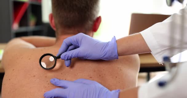 Dermatologista Examina Toupeira Nas Costas Com Uma Lupa Close Slow — Vídeo de Stock