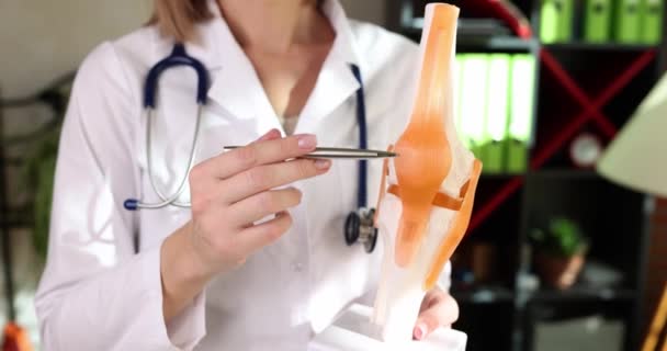 Doctor Shows Anatomical Model Human Knee Close Treatment Musculoskeletal System — Stok video
