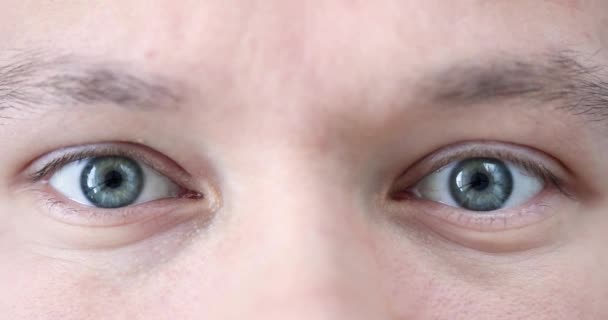 Ojos Joven Con Pupilo Gris Verde Concepto Corrección Visión Láser — Vídeo de stock