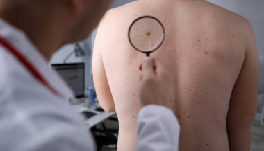 Erkek doktor, hastanın cildindeki büyüteçle hastane geçmişini karşılaştırıyor. Lezyon sorunu terapi konsepti