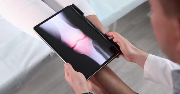 Doctor Traumatologist Scanning Knee Joint Woman Using Digital Tablet Closeup — Stock Video
