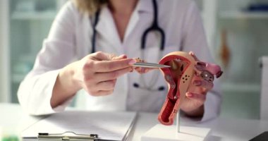 Kadın cinsel organlarının yapısı ve libidosu. Vajinal kandiyaz semptomlara neden olur.