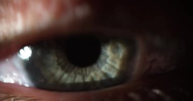 Gri gözlerini açan Makro güzellik, korkmuş, sağlıklı bir görüşe sahip gibi görünüyor. Hyperopia, miyop astigmat ve lazer görme düzeltmesi.